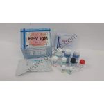 Hev Igm Elisa Kit